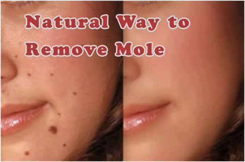 NATURAL TIPS FOR MOLE REMOVAL