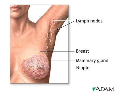 Breast Cancer,women