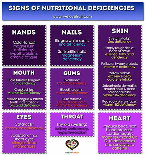 signs of nutritional deficiencies 