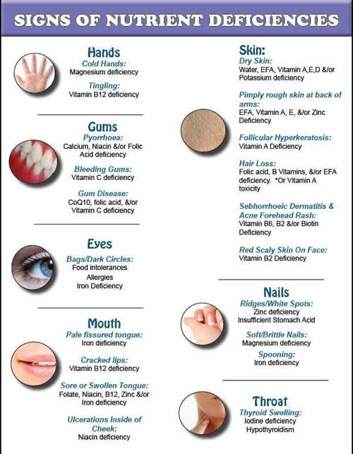 Signs of Nutrient Deficiencies 