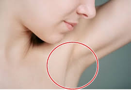 Top 5 Home Remedies For Dark Underarms~