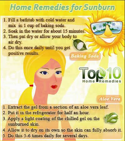 Home remedies for sunburn  Daily Inspirations for Healthy Living