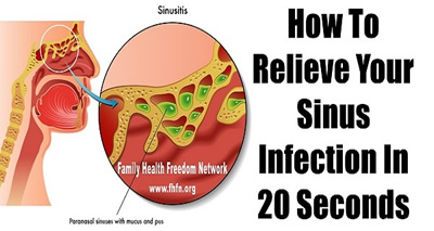 How to Relieve Your Sinus Infection,home remedy